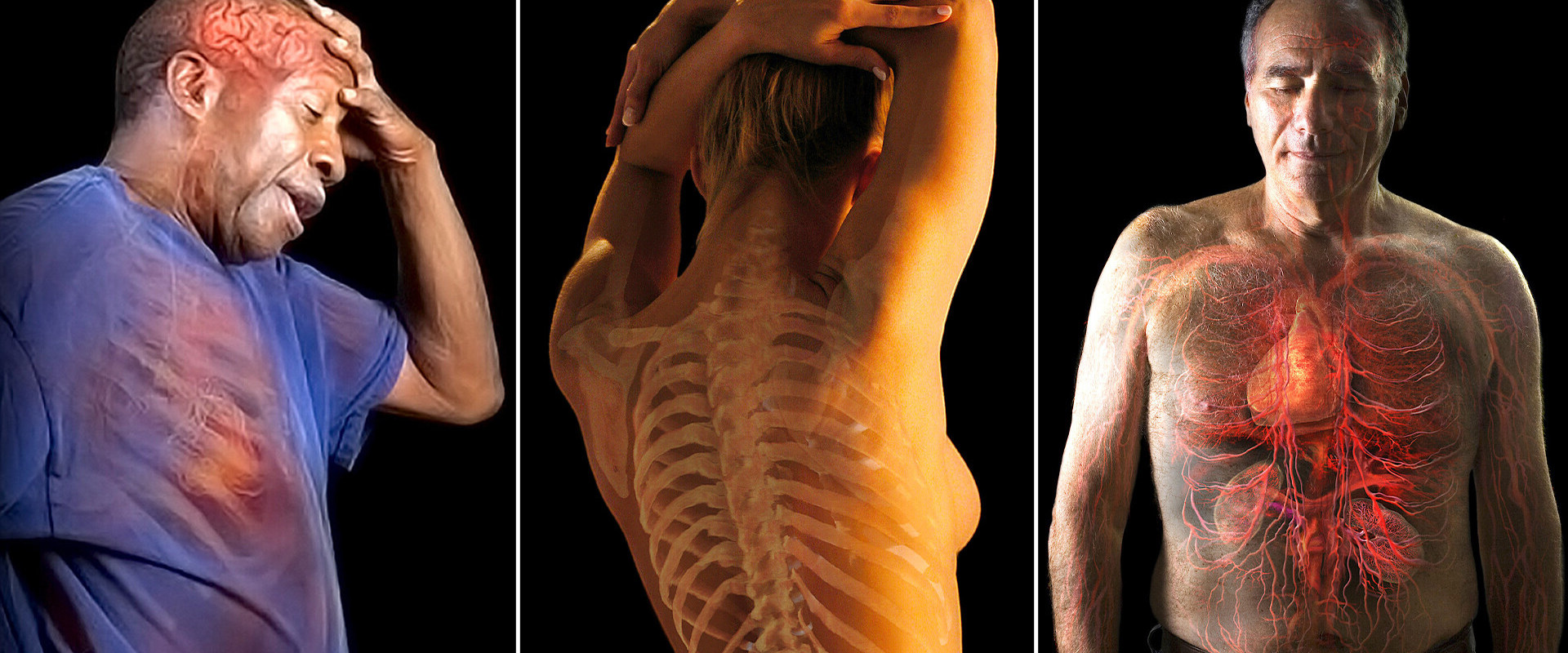 Understanding Muscle Weakness: The Essential Role of Vitamin D3