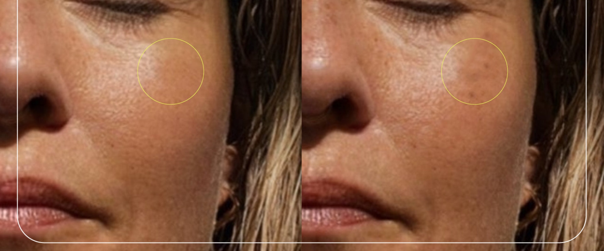 Understanding Recommended Daily Sun Exposure Time for Optimal Vitamin D3 Levels Based on Skin Type