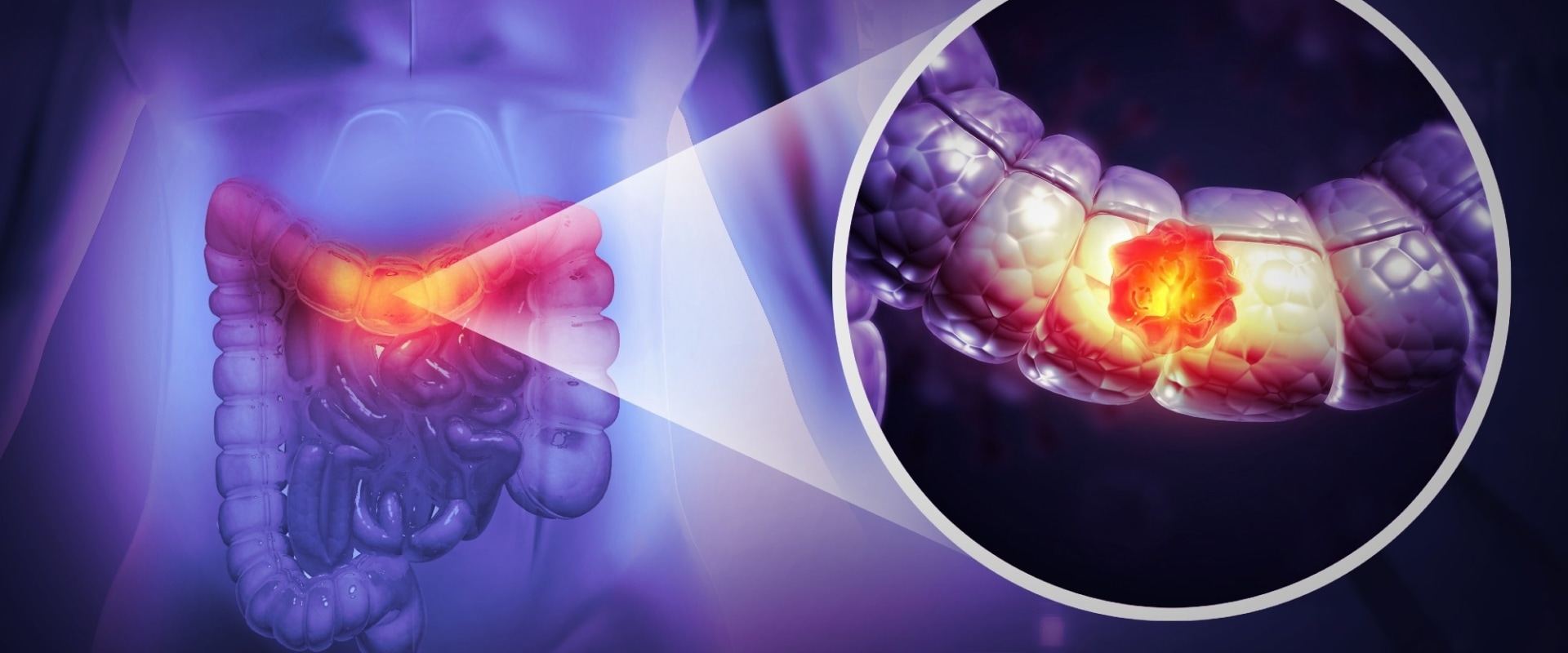 The Role of Vitamin D3 in Cancer Prevention: Insights and Implications