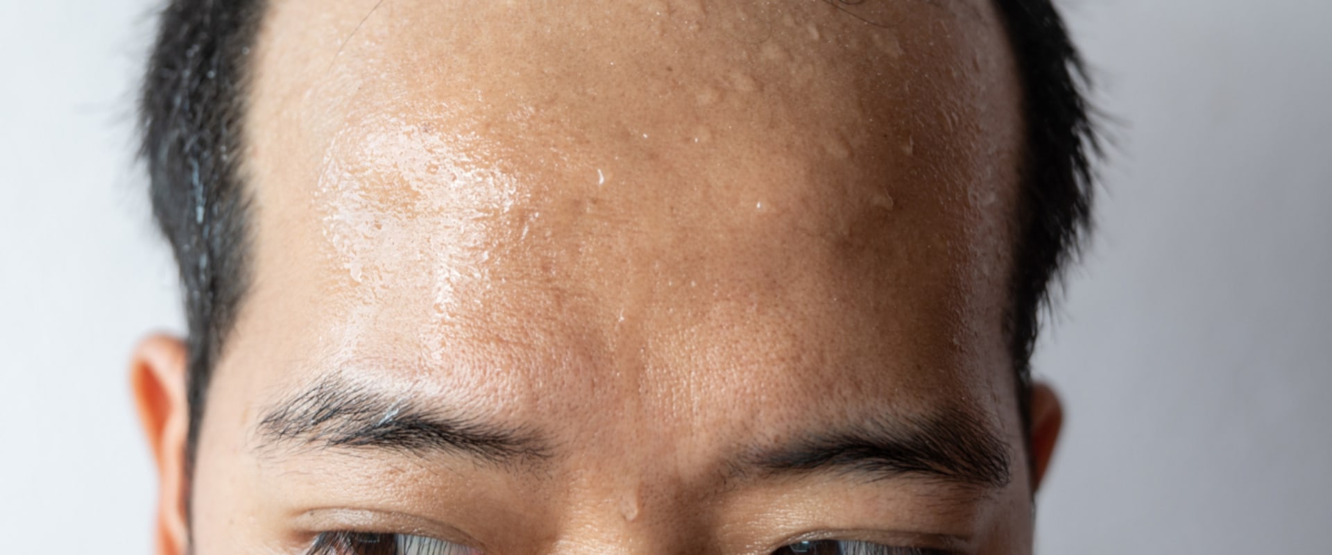 The Role of Vitamin D3 in Combating Skin Aging: Benefits, Sources, and Recommendations