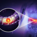 The Link Between Vitamin D3 and Cancer Prevention