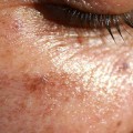 Understanding Dark Skin Pigmentation: A Comprehensive Guide to Vitamin D3 Benefits, Sources, and Deficiencies
