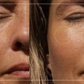 Recommended Daily Sun Exposure Time Based on Skin Type