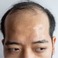 The Impact of Vitamin D3 on Skin Aging