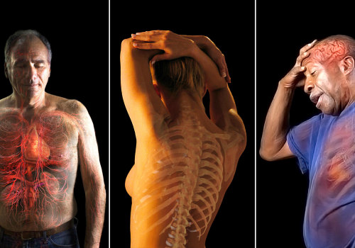 Understanding Muscle Weakness: The Role of Vitamin D3