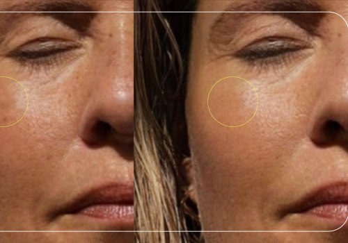 Recommended Daily Sun Exposure Time Based on Skin Type