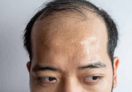 The Impact of Vitamin D3 on Skin Aging